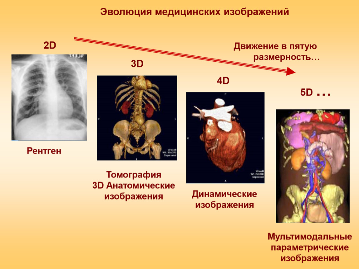 Medical evolution. Эволюция медицинских изображений. Роль эволюции в медицине. Эволюция медика. Эволюция моделей медицины в развитии современной культуры.