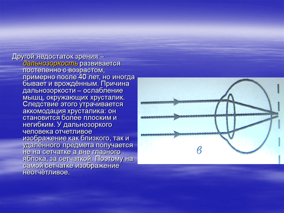 Недостатки зрения. Глаз и оптические приборы физика. Глаз и зрение оптические приборы. Глаз как оптическая система оптические приборы. Прибор для дальнозоркости.