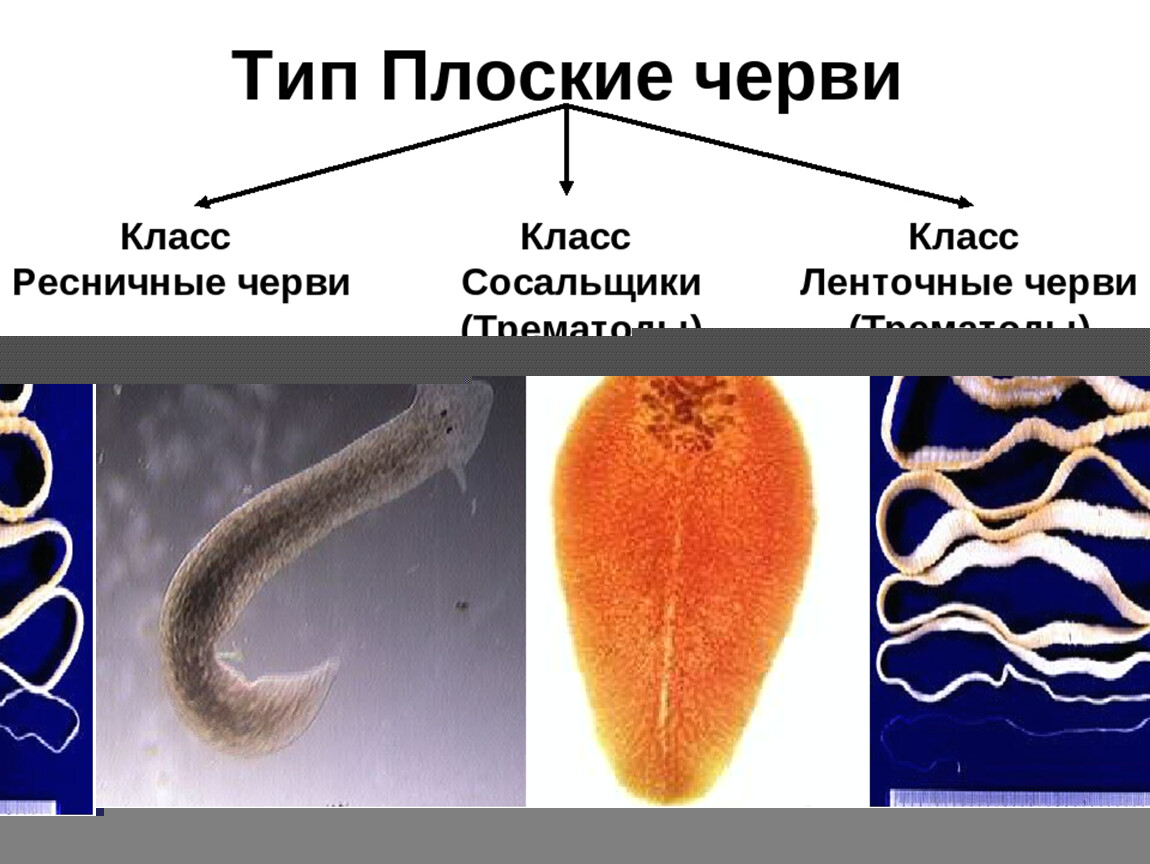 Типы червей картинки