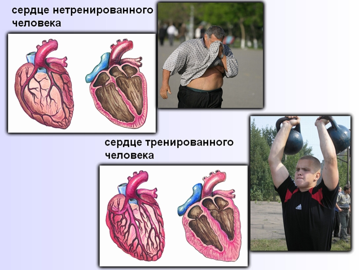 Сердцем отличай. Сердце тренированного и нетренированного человека. Сердце спортсмена и обычного человека. Сердце спортсмена и сердце обычного человека.