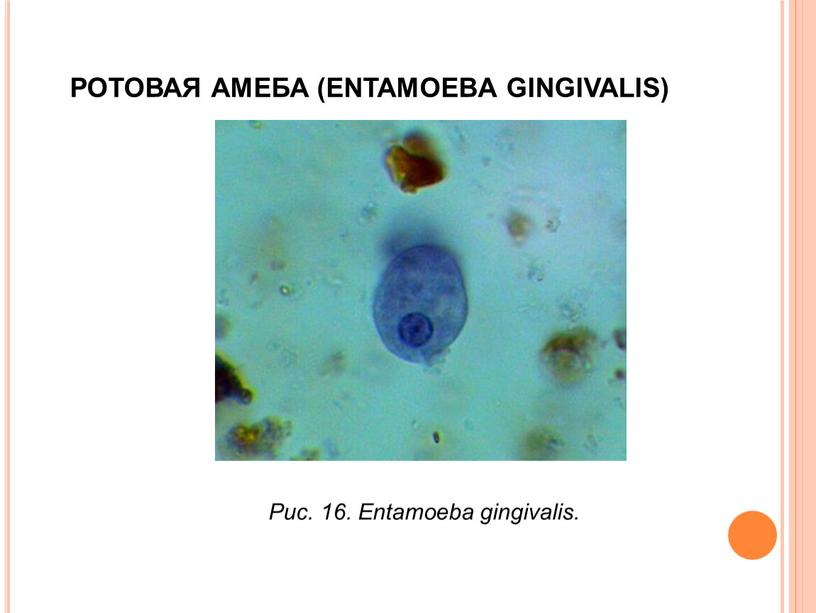 РОТОВАЯ АМЕБА (ENTAMOEBA GINGIVALIS)