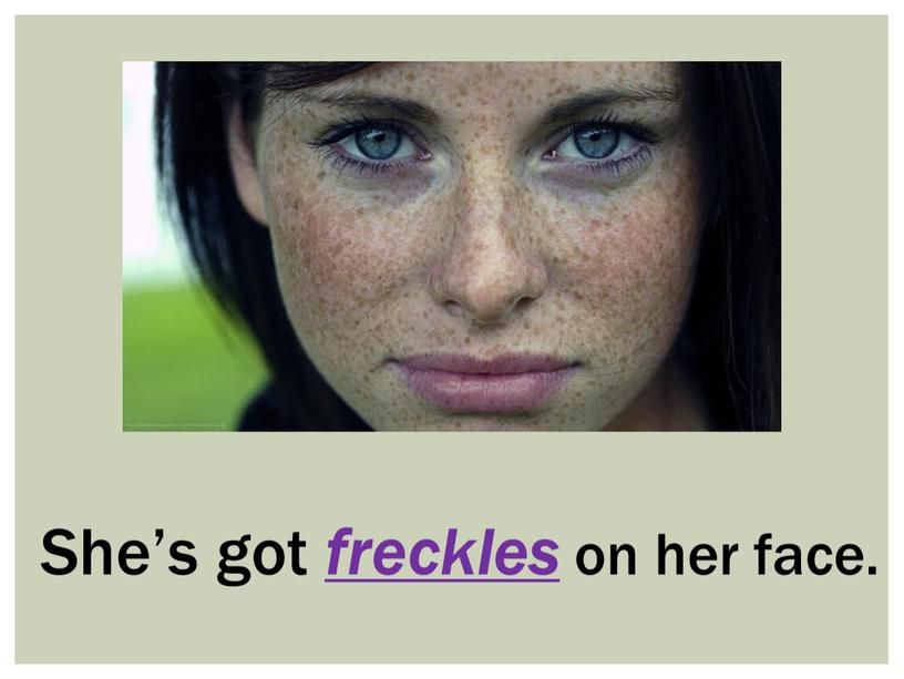 She’s got freckles on her face
