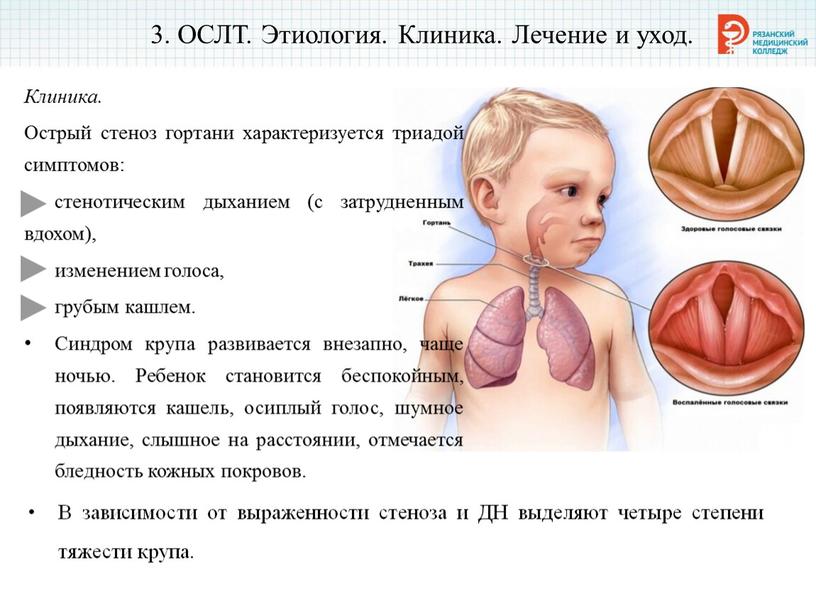 ОСЛТ. Этиология. Клиника. Лечение и уход