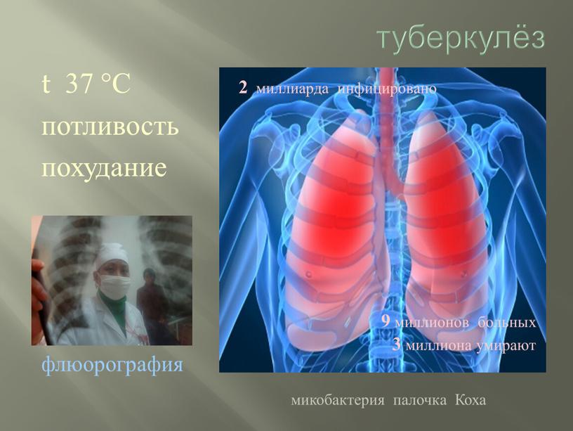 C потливость похудание флюорография микобактерия палочка