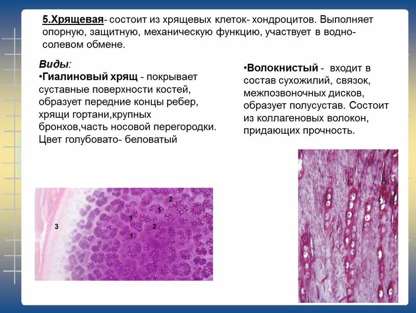 Хрящевая - состоит из хрящевых клеток- хондроцитов