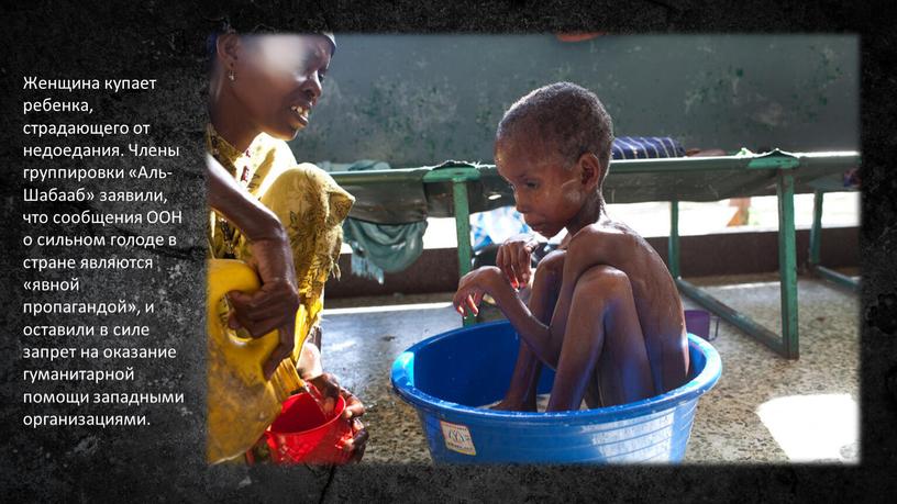 Женщина купает ребенка, страдающего от недоедания