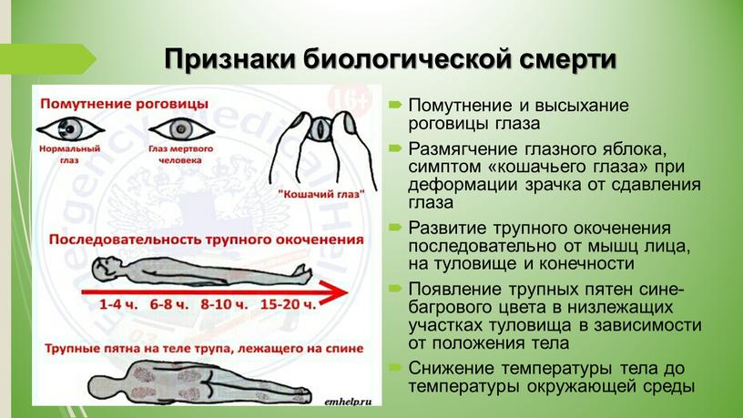 Признаки биологической смерти Помутнение и высыхание роговицы глаза