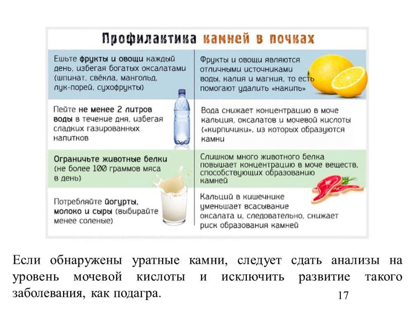 Если обнаружены уратные камни, следует сдать анализы на уровень мочевой кислоты и исключить развитие такого заболевания, как подагра