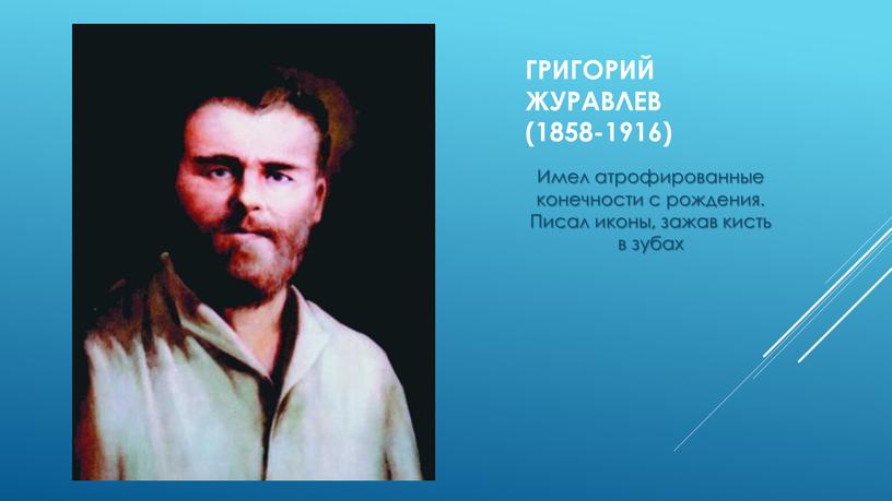 Григорий Журавлев (1858-1916) Имел атрофированные конечности с рождения