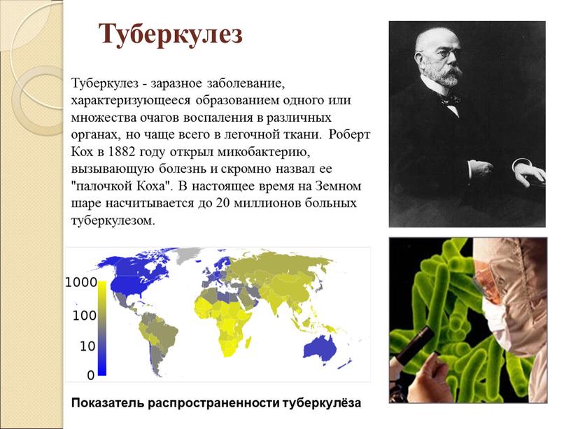 Туберкулез Туберкулез - заразное заболевание, характеризующееся образованием одного или множества очагов воспаления в различных органах, но чаще всего в легочной ткани