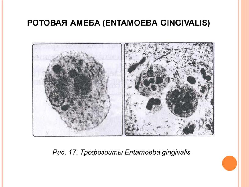 РОТОВАЯ АМЕБА (ENTAMOEBA GINGIVALIS)