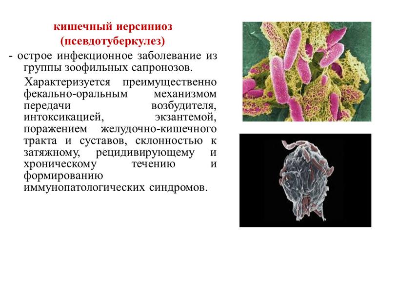 Характеризуется преимущественно фекально-оральным механизмом передачи возбудителя, интоксикацией, экзантемой, поражением желудочно-кишечного тракта и суставов, склонностью к затяжному, рецидивирующему и хроническому течению и формированию иммунопатологических синдромов