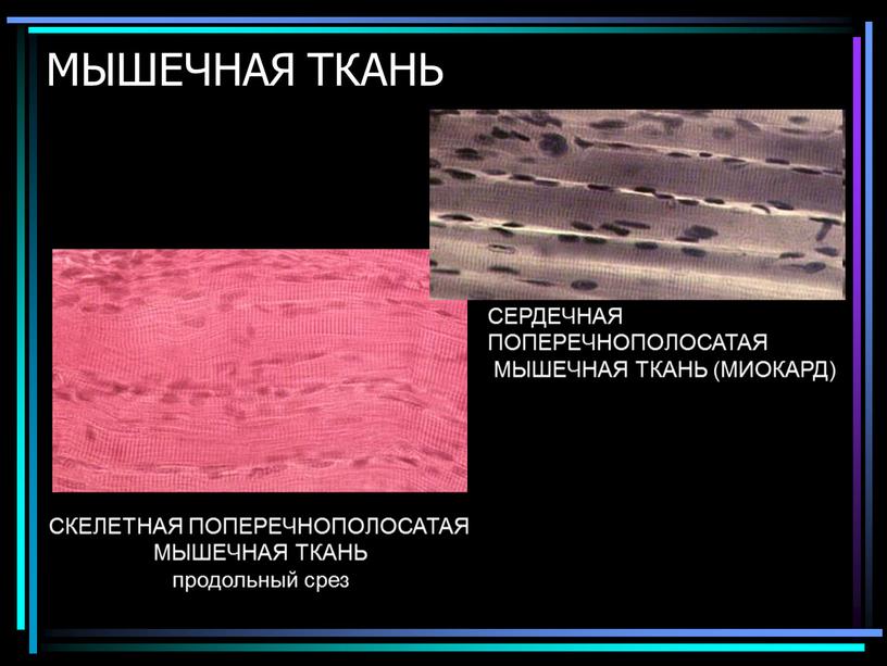 МЫШЕЧНАЯ ТКАНЬ СКЕЛЕТНАЯ ПОПЕРЕЧНОПОЛОСАТАЯ