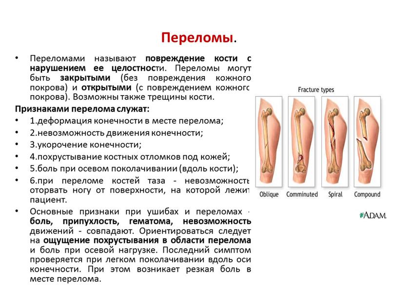 Переломы . Переломами называют повреждение кости с нарушением ее целостнос ти