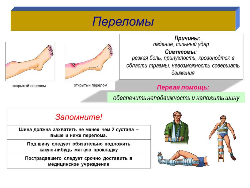 Переломы Запомните! падение, сильный удар