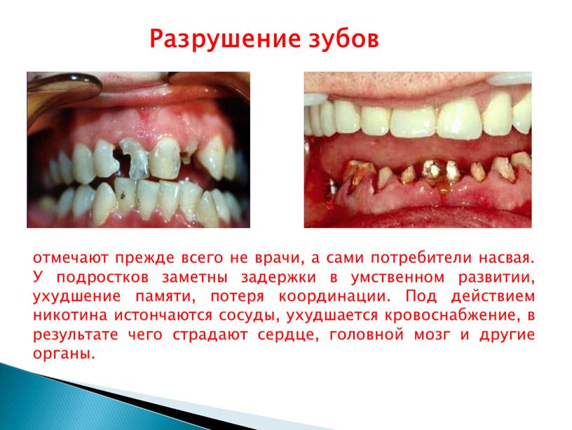 У подростков заметны задержки в умственном развитии, ухудшение памяти, потеря координации