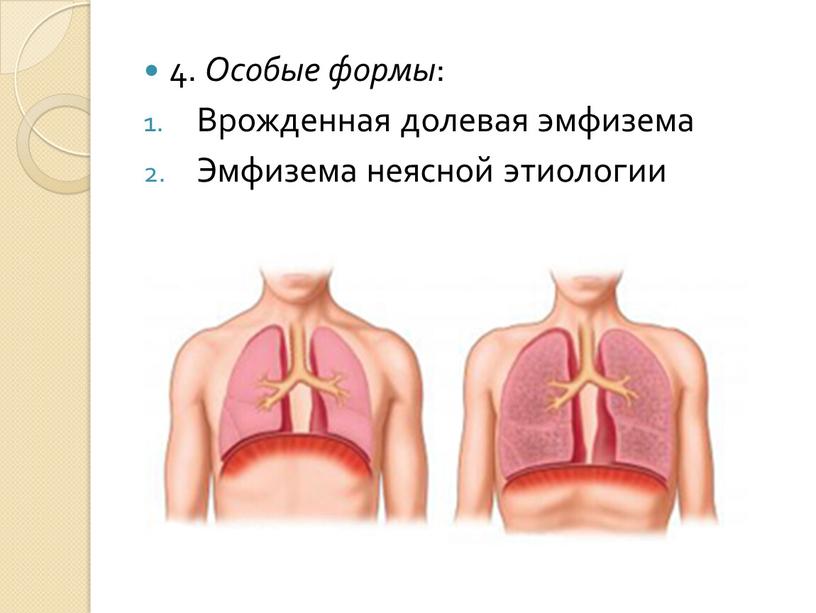 Особые формы : Врожденная долевая эмфизема