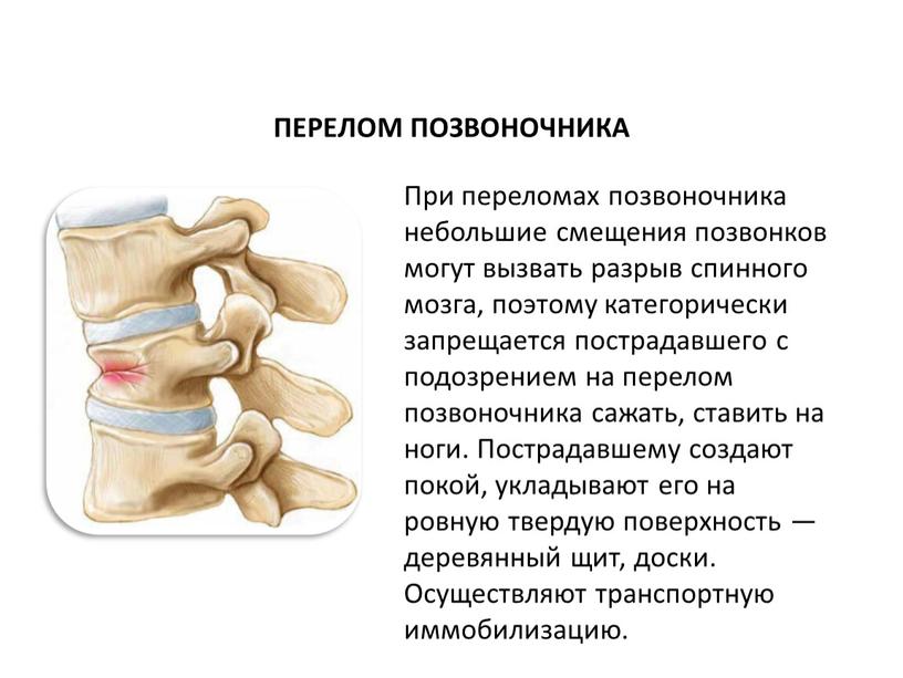 ПЕРЕЛОМ ПОЗВОНОЧНИКА При переломах позвоночника небольшие смещения позвонков могут вызвать разрыв спинного мозга, поэтому категорически запрещается пострадавшего с подозрением на перелом позвоночника сажать, ставить на…