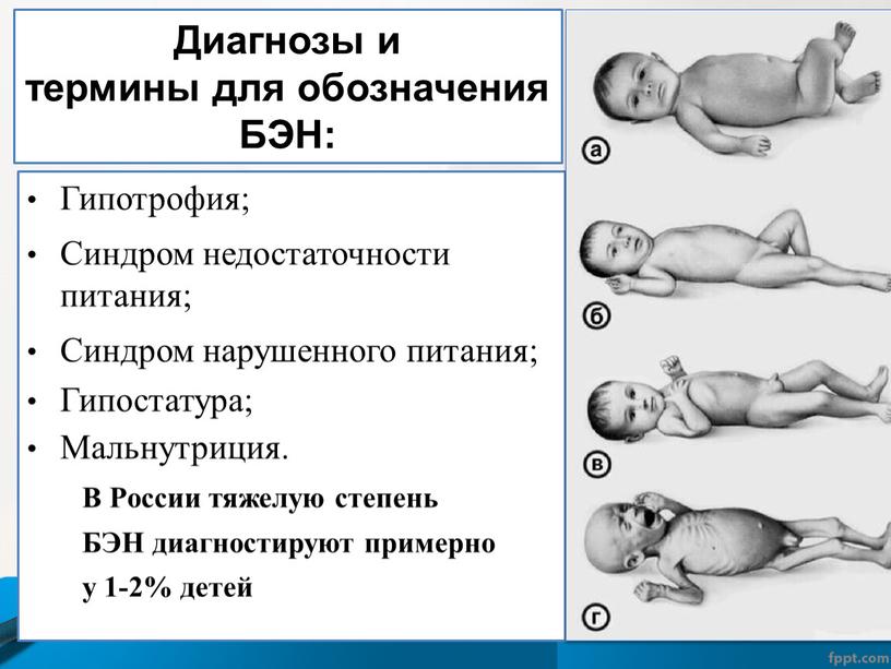 Гипотрофия; Синдром недостаточности питания;