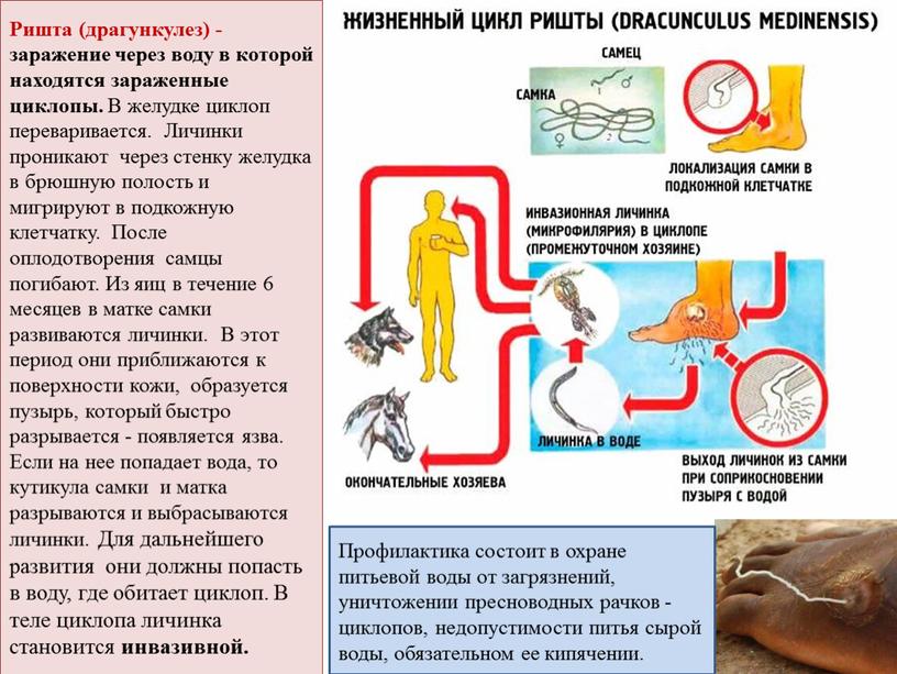 Ришта (драгункулез) - заражение через воду в которой находятся зараженные циклопы