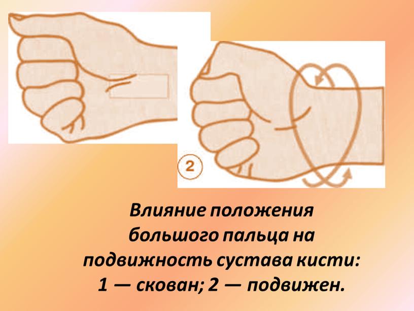 Влияние положения большого пальца на подвижность сустава кисти: 1 — скован; 2 — подвижен