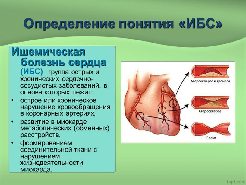 Определение понятия «ИБС» Ишемическая болезнь сердца (ИБС) - группа острых и хронических сердечно-сосудистых заболеваний, в основе которых лежит: острое или хроническое нарушение кровообращения в коронарных…