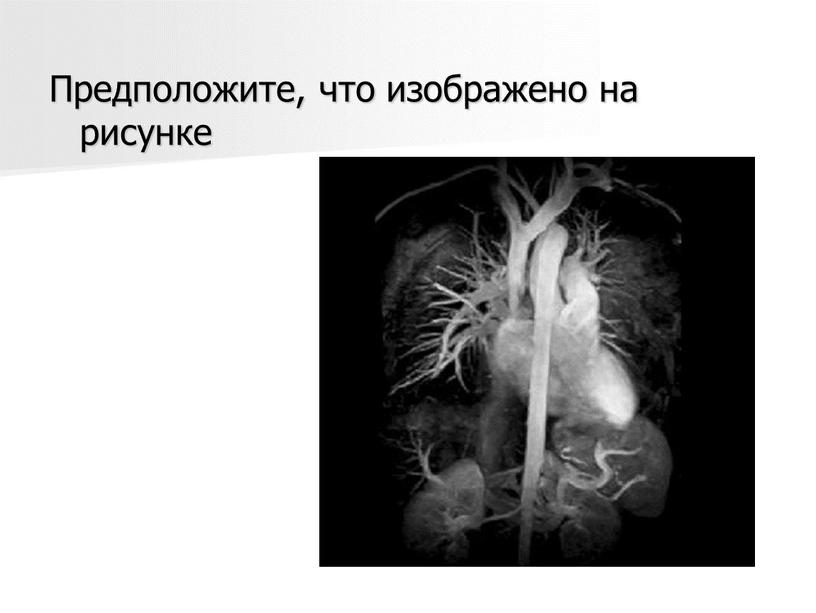 Предположите, что изображено на рисунке