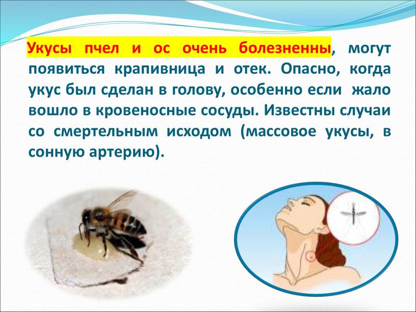 Укусы пчел и ос очень болезненны, могут появиться крапивница и отек