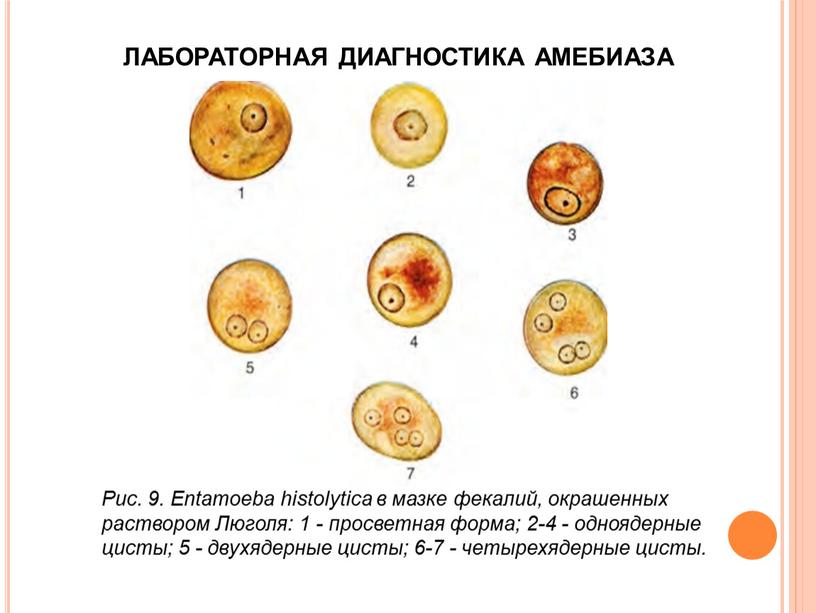 ЛАБОРАТОРНАЯ ДИАГНОСТИКА АМЕБИАЗА