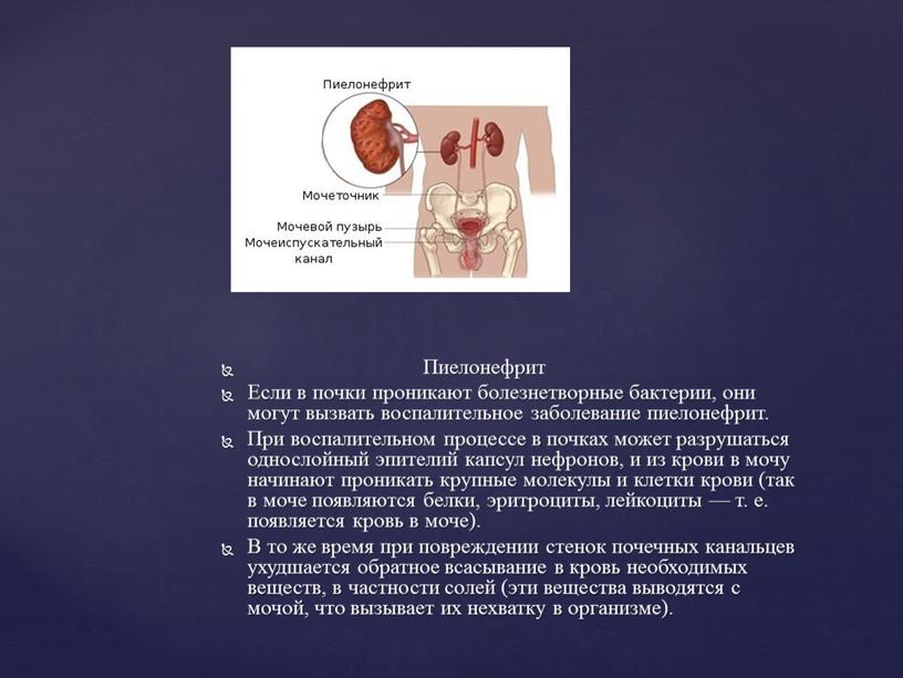 Пиелонефрит Если в почки проникают болезнетворные бактерии, они могут вызвать воспалительное заболевание пиелонефрит