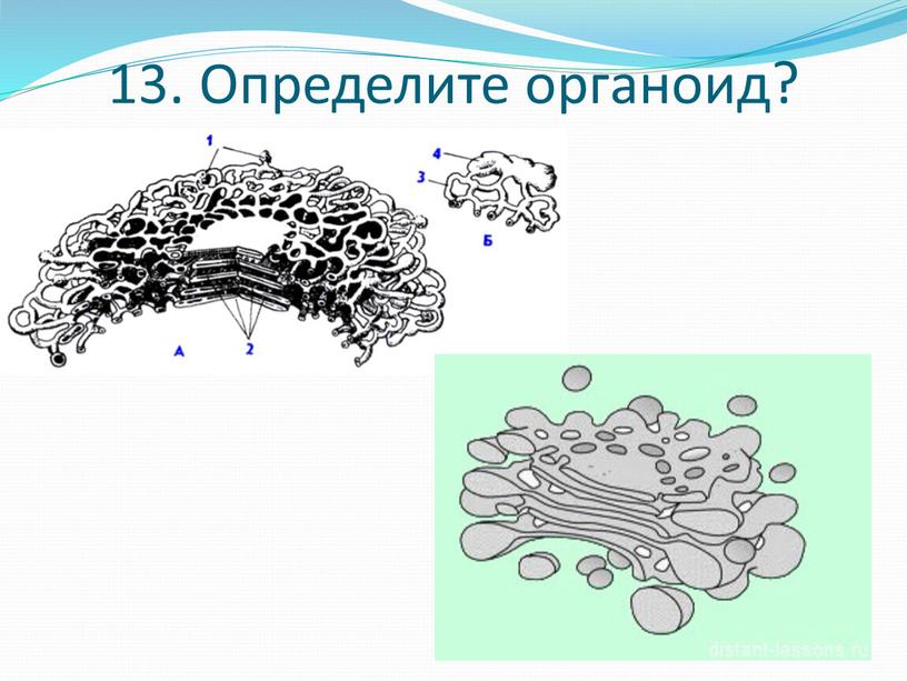 13. Определите органоид?