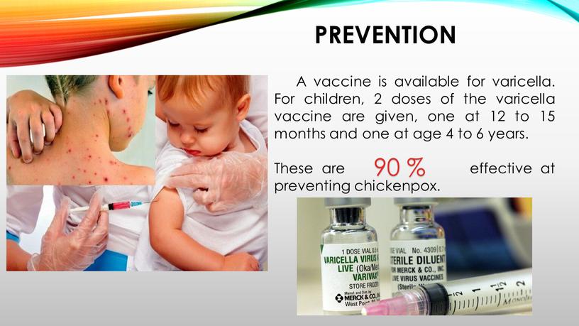 PREVENTION A vaccine is available for varicella