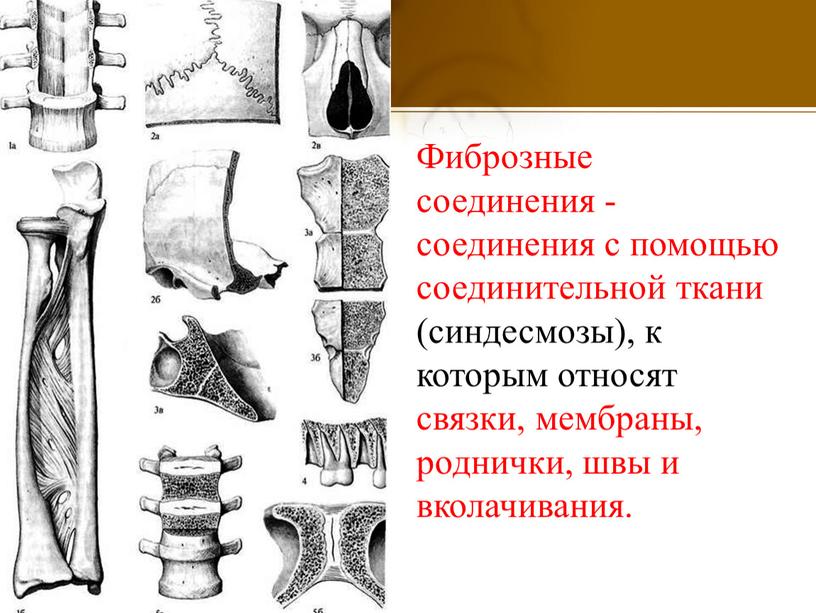 Фиброзные соединения - соединения с помощью соединительной ткани (синдесмозы), к которым относят связки, мембраны, роднички, швы и вколачивания