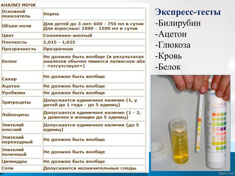 Экспресс-тесты Билирубин Ацетон