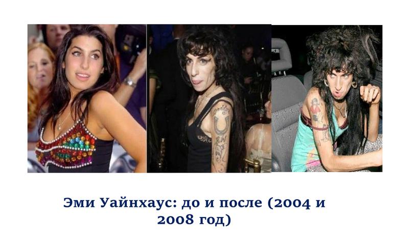 Эми Уайнхаус: до и после (2004 и 2008 год)