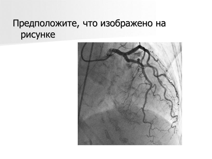 Предположите, что изображено на рисунке