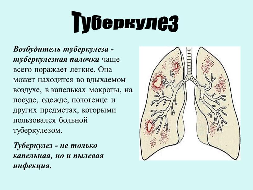 Туберкулез Возбудитель туберкулеза - туберкулезная палочка чаще всего поражает легкие