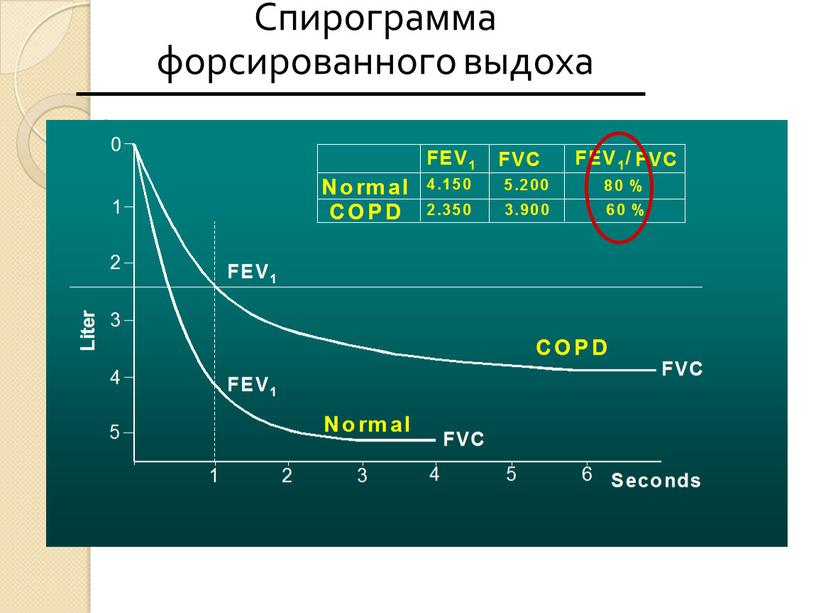 Спирограмма форсированного выдоха