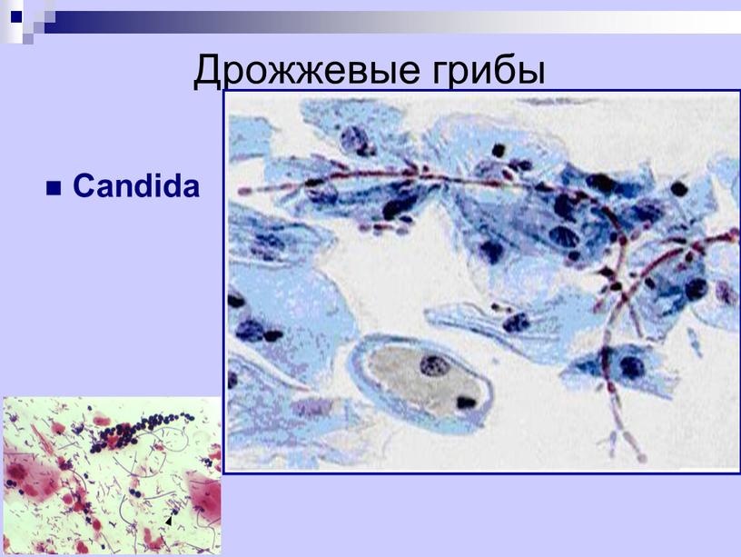 Дрожжевые грибы Candida