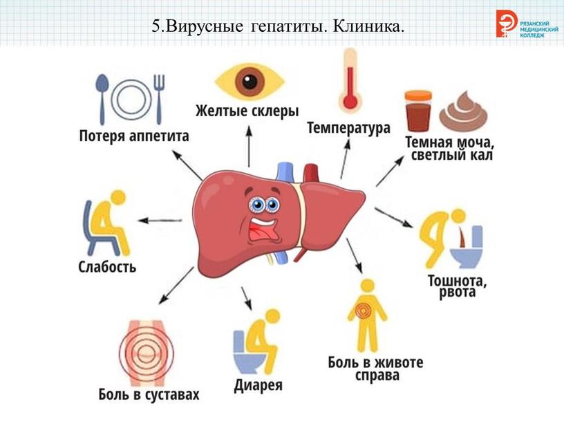 5.Вирусные гепатиты. Клиника.