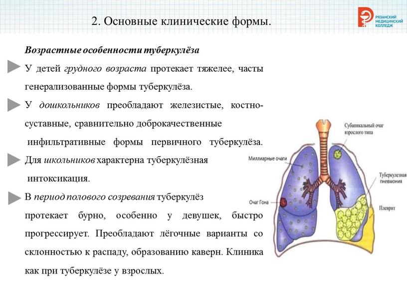 Основные клинические формы. Возрастные особенности туберкулёза