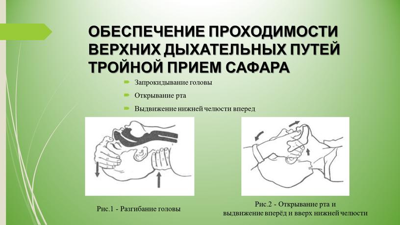 ОБЕСПЕЧЕНИЕ ПРОХОДИМОСТИ ВЕРХНИХ