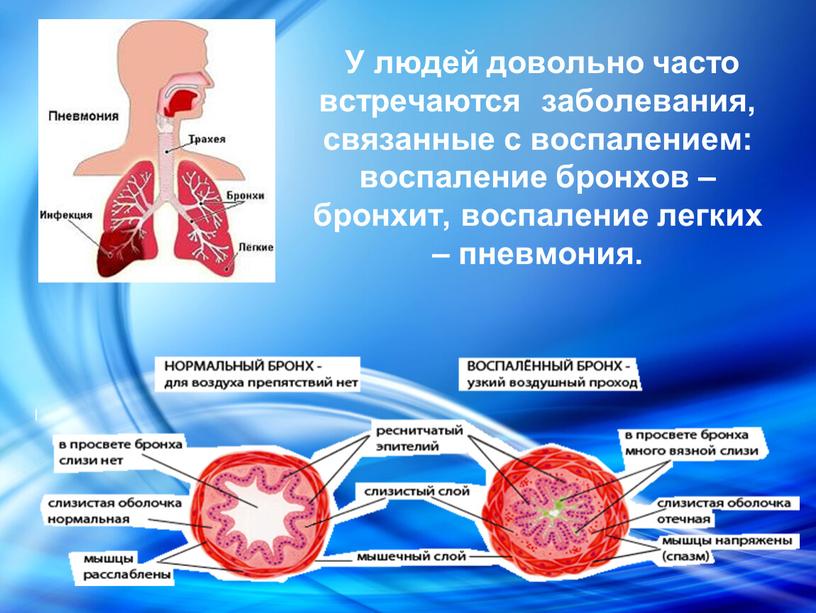 У людей довольно часто встречаются заболевания, связанные с воспалением: воспаление бронхов – бронхит, воспаление легких – пневмония