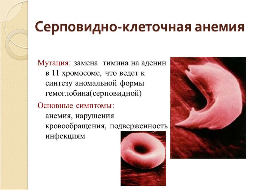 Серповидноклеточная анемия картина крови