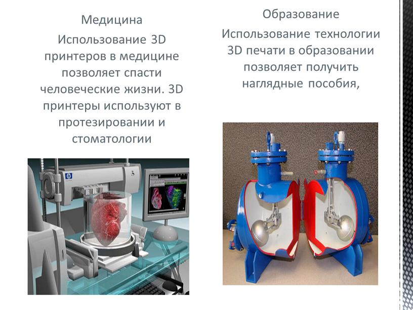 Медицина Использование 3D принтеров в медицине позволяет спасти человеческие жизни
