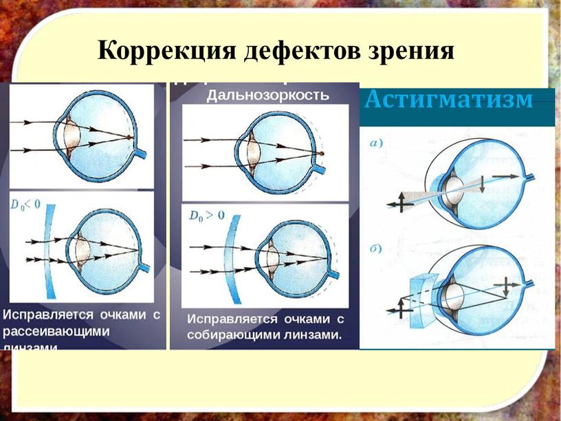 Коррекция дефектов зрения