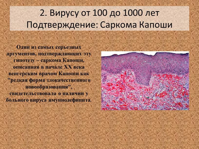 Вирусу от 100 до 1000 лет Подтверждение: