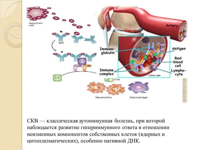 СКВ — классическая аутоиммунная болезнь, при которой наблюдается развитие гипериммунного ответа в отношении неизменных компонентов собственных клеток (ядерных и цитоплазматических), особенно нативной