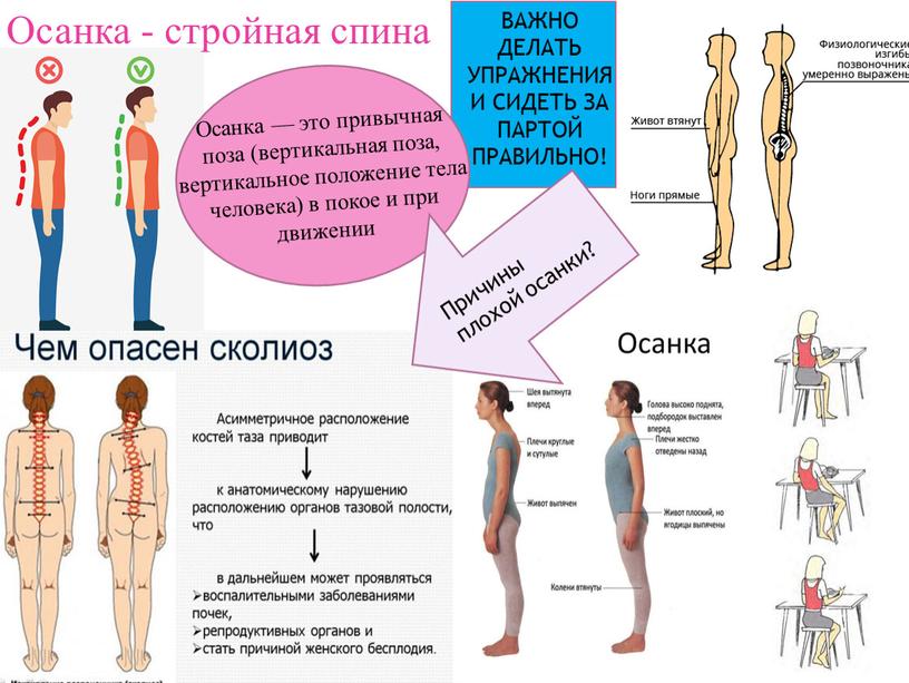 Осанка - стройная спина Осанка — это привычная поза (вертикальная поза, вертикальное положение тела человека) в покое и при движении