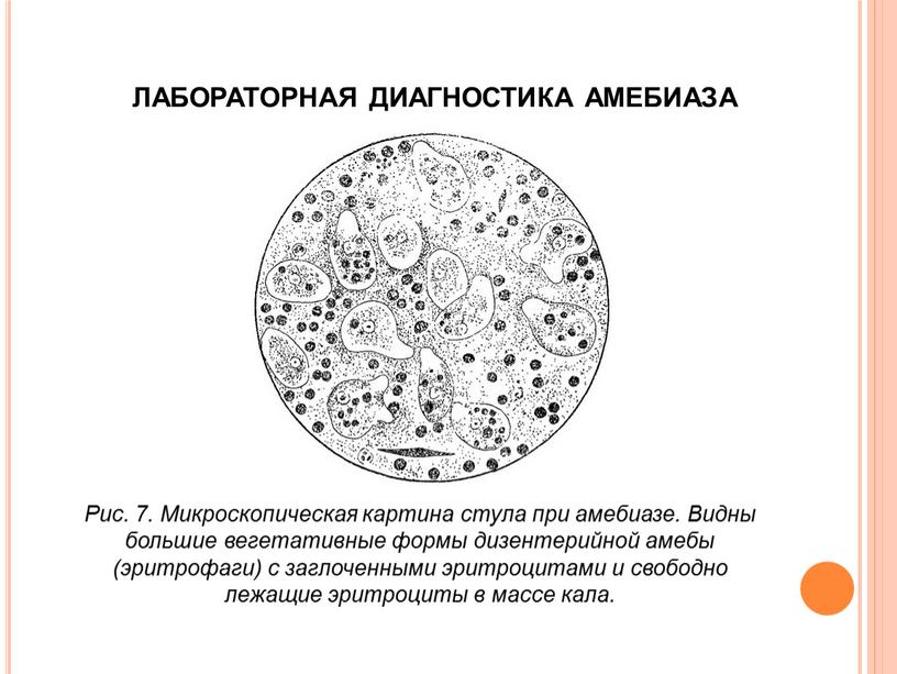 ЛАБОРАТОРНАЯ ДИАГНОСТИКА АМЕБИАЗА